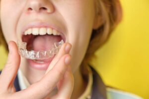 A person cleans a clear dental retainer beside an open protective case and soft toothbrush.