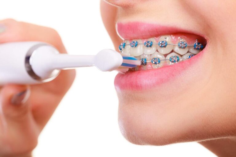 Clear dental retainer in a protective case beside a toothbrush and glass of cool water.